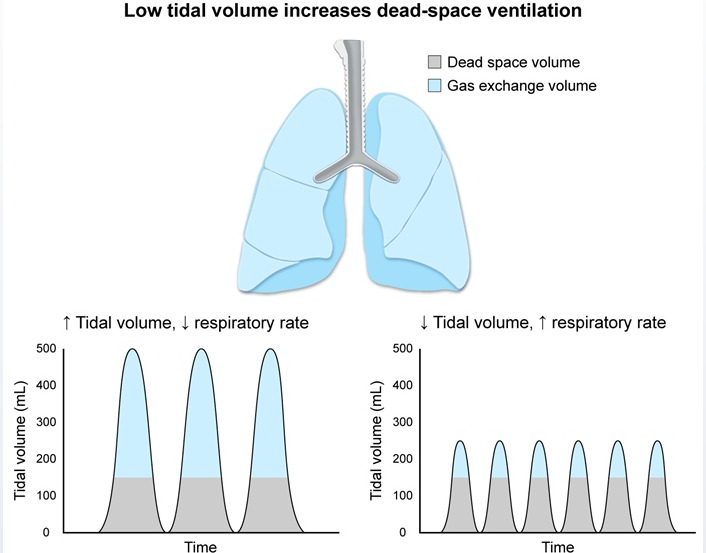 what increases dead space in lungs