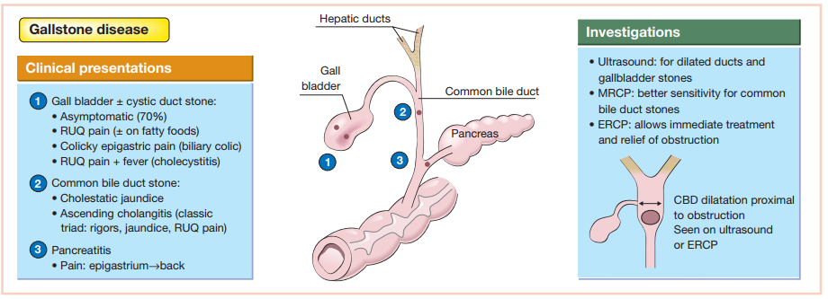 GALL BLADDER DISEASES (Bile Duct Disorders (*Carcinoma of ...