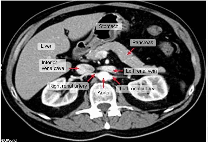 Abdominal CT Scan Anatomy