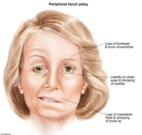 Neurology - Cranial Nerves (dropped image link (CN 10 = *Vagus nerve