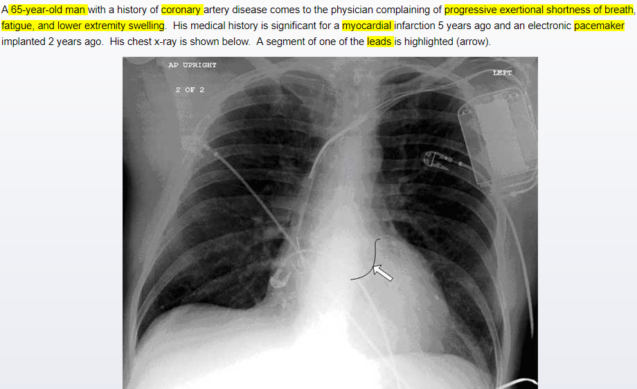 Cardiology - Physiology / Anatomy (Normal Heart Chamber Pressures…