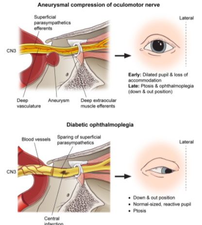 Neurology - Cranial Nerves (dropped Image Link (cn 10 = *vagus Nerve