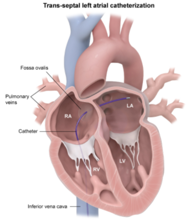 Cardiology - Physiology / Anatomy (Normal Heart Chamber Pressures…