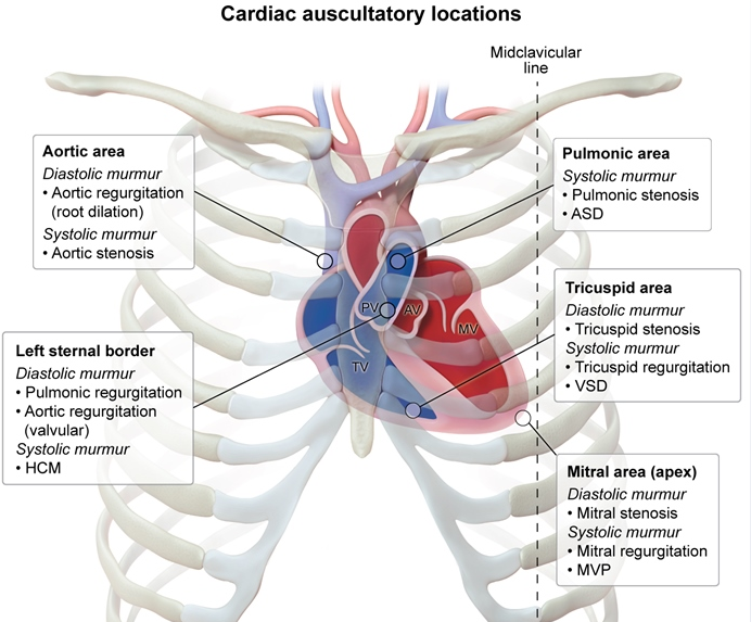 Cardiology - Heart Sounds and Murmurs (*Murmurs and Gallops (dropped image…