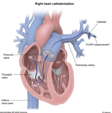 Cardiology - Physiology / Anatomy (Normal Heart Chamber Pressures…