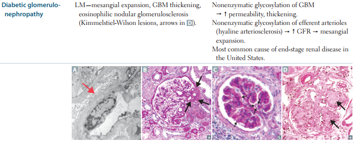 GLOMERULUS (. (. (. (.. (. (. (. (. (. (. (. (. (. (. (. (. (. (Thick…